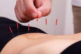 Frecuencia óptima para el tratamiento de acupuntura
